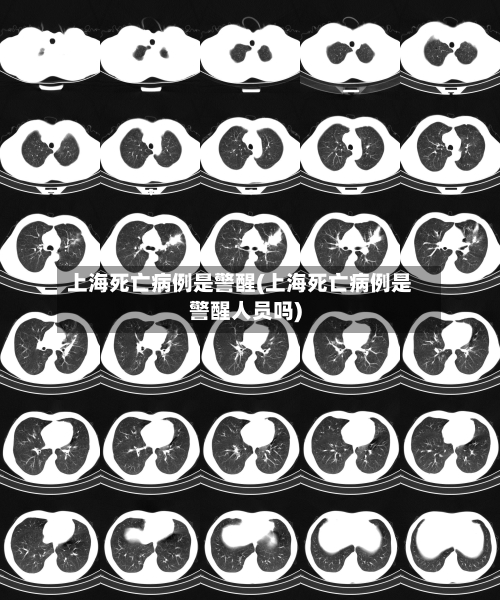 上海死亡病例是警醒(上海死亡病例是警醒人员吗)